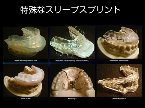 当院における無呼吸治療の進め方③