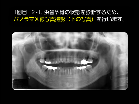 当院における無呼吸治療の進め方③