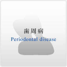 歯周病 Periodontal disease